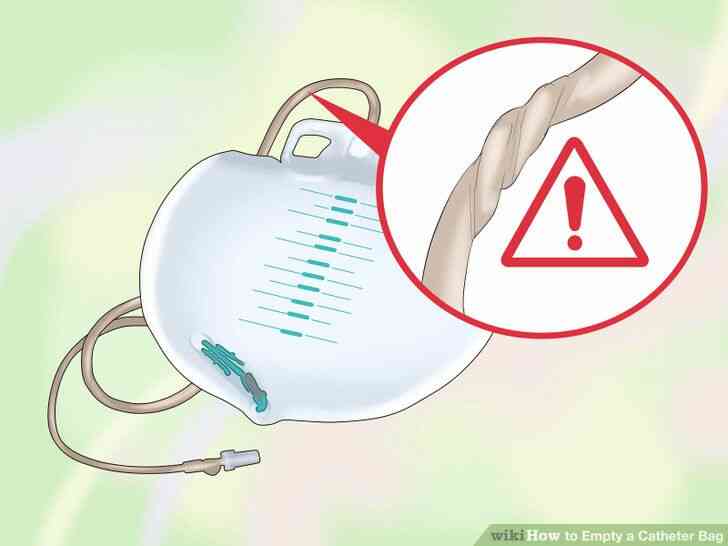 Image intitulée Vide un Cathéter Sac Étape 9